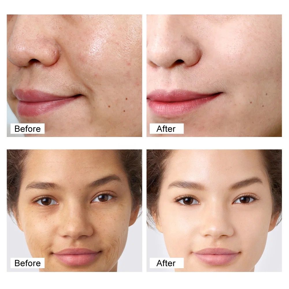 Retinol Cream