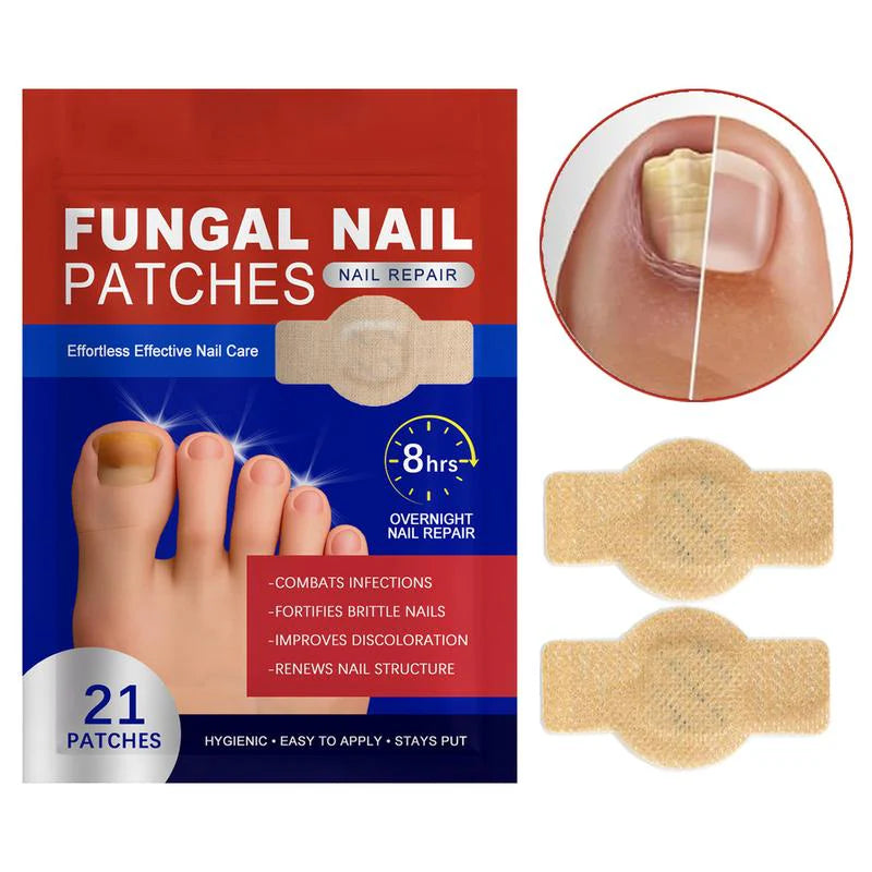 Toenail Fungus (21 patches)