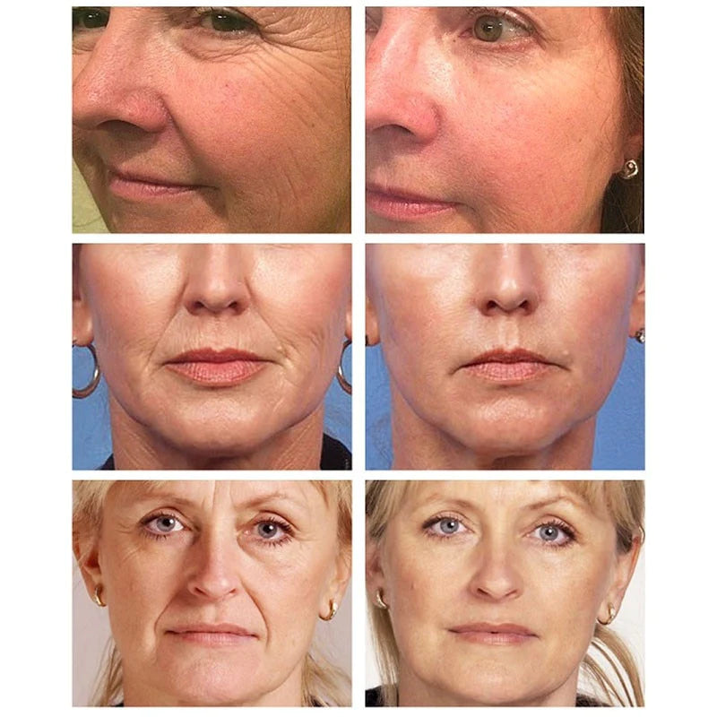 Gold Nicotinamide Anti-Ageing Essence