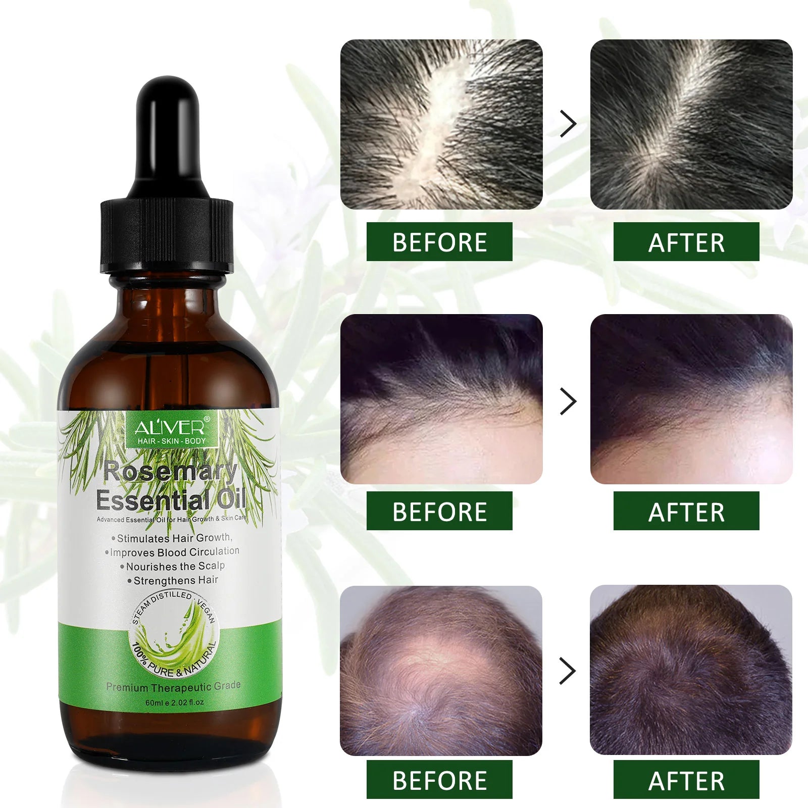 Rosemary Hair Growth Oil - ALIVER